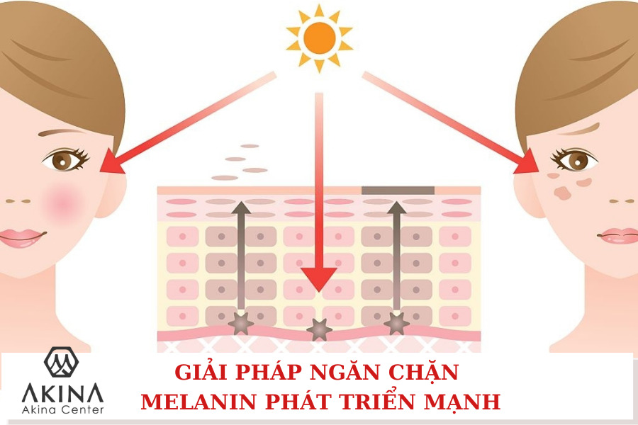 Laser CO2 là một trong những phương pháp làm giảm lượng melanin dưới da nhanh và hiệu quả nhất.