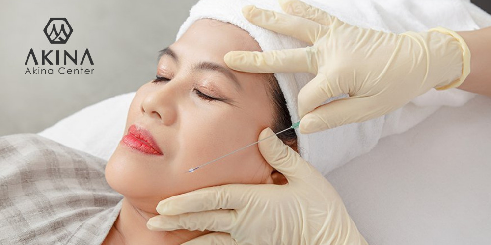 Khách hàng trải nghiệm căng da mặt bằng chỉ collagen tại Akina Center