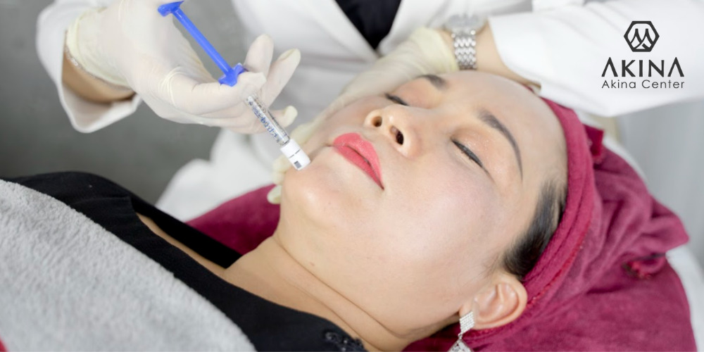 Phương pháp Mesotherapy có ưu điểm kép, vừa điều trị nám dứt điểm vừa trẻ hóa làn da