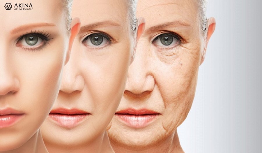 Độ tuổi phù hợp với phương pháp căng chỉ collagen