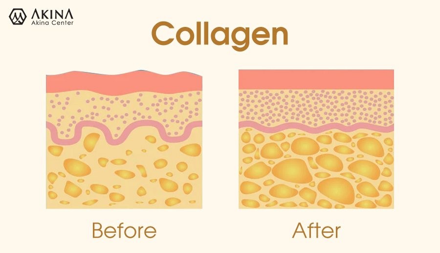 Nam giới có cần bổ sung collagen không? Collagen là gì?