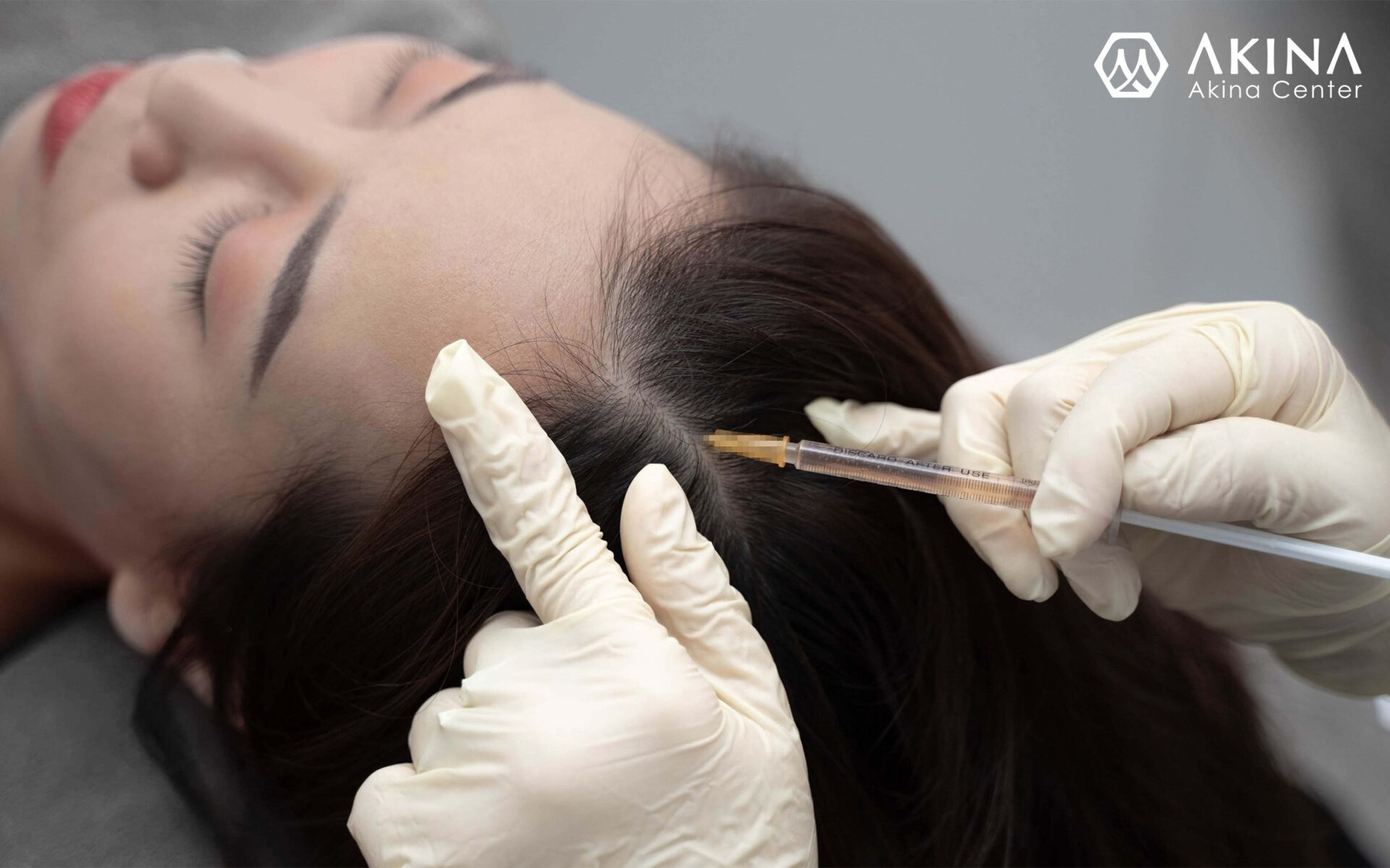 Phương pháp điều trị rụng tóc, hói tóc công nghệ cao - Điều trị rụng tóc, hói tóc tại Đà Nẵng