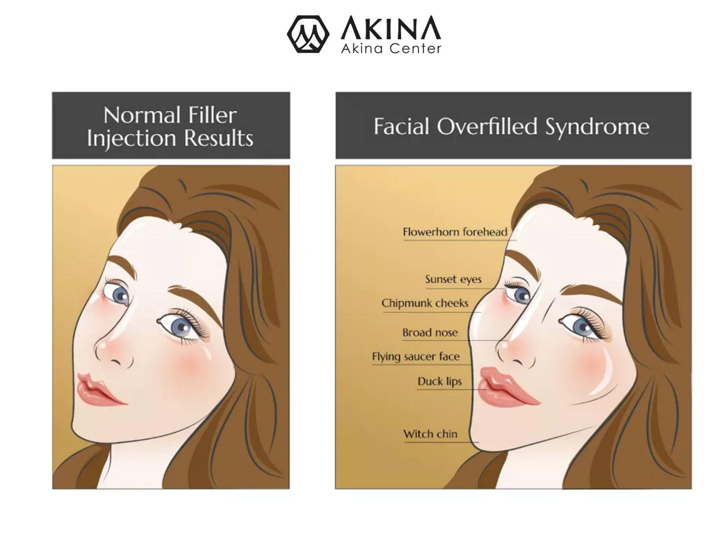 A comparison of a person's face

AI-generated content may be incorrect.